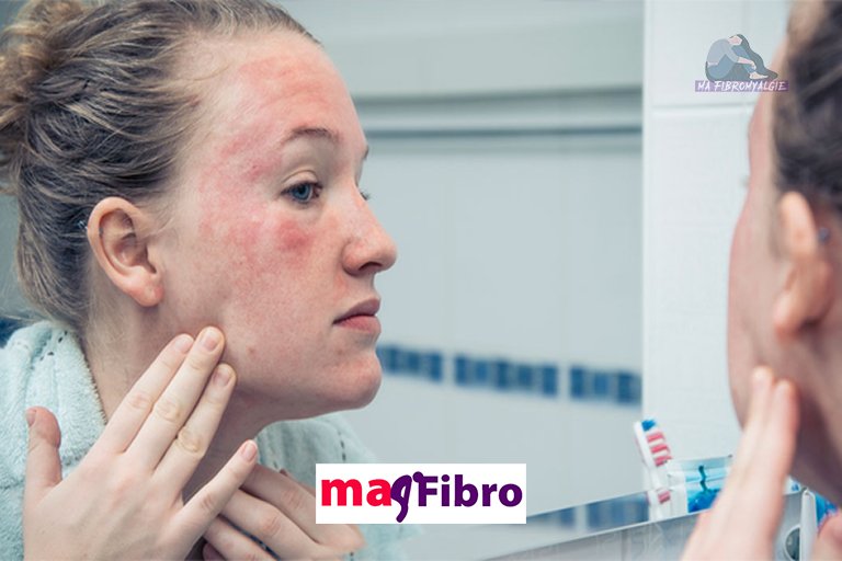 Problèmes de peau de fibromyalgie et comment les gérer