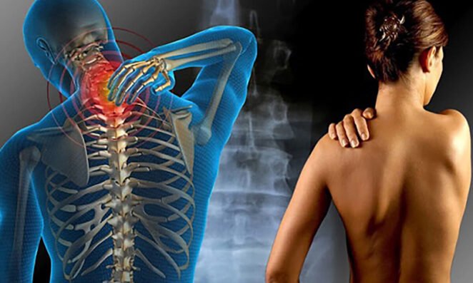 Fibromyalgie Apa