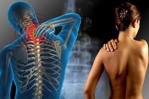 Les Effets Secondaires De La Fibromyalgie Personne Ne Parle De