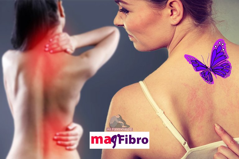 251 symptômes de la fibromyalgie (difficile à croire). Quels sont les vôtres ?