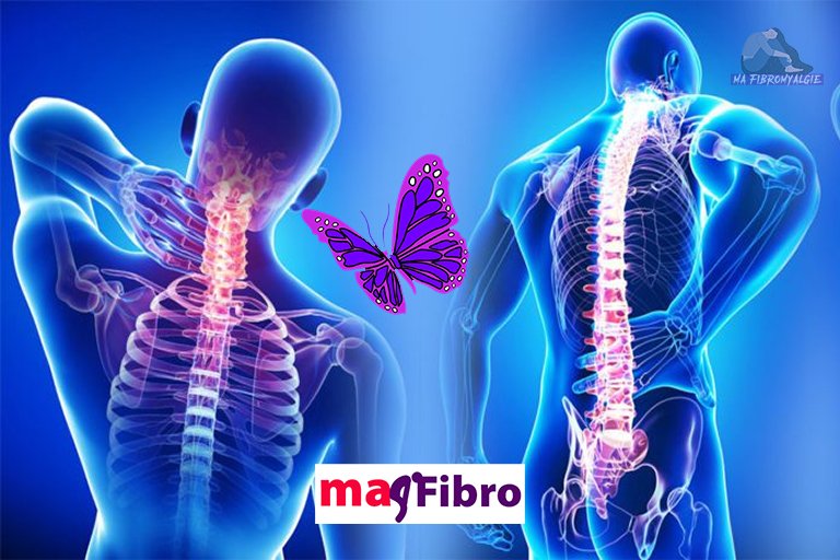 33 symptômes surprenants de la fibromyalgie