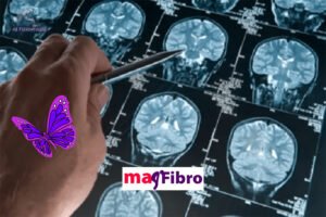 La fibromyalgie est désormais considérée comme un trouble du système nerveux central à vie