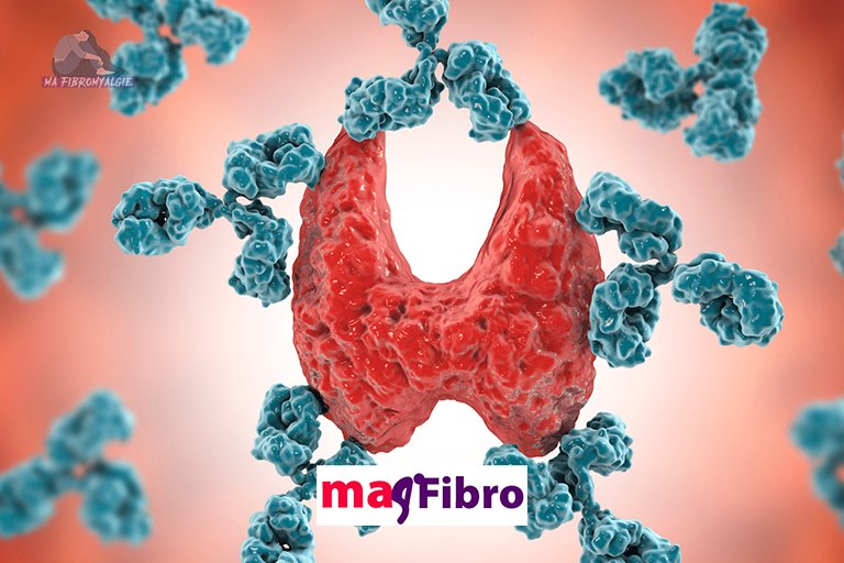 La fibromyalgie est probablement le résultat d’un problème auto-immun, selon une étude.